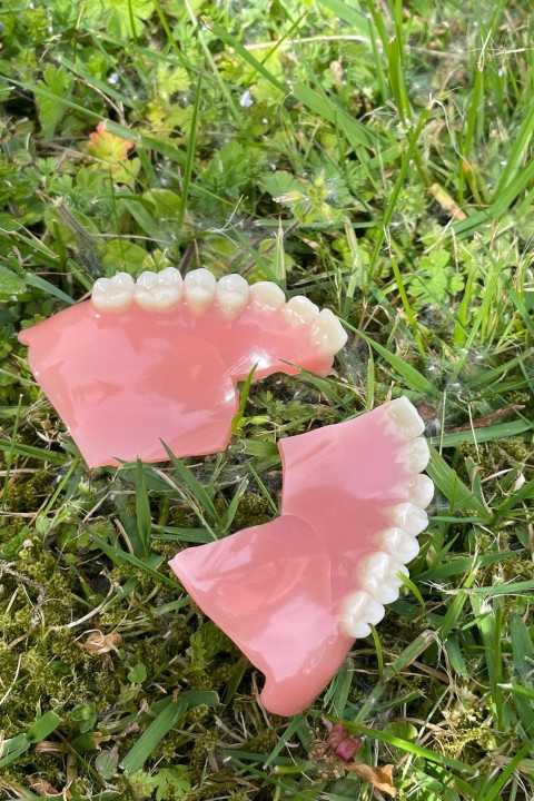 Zahnersatz - Reparatur